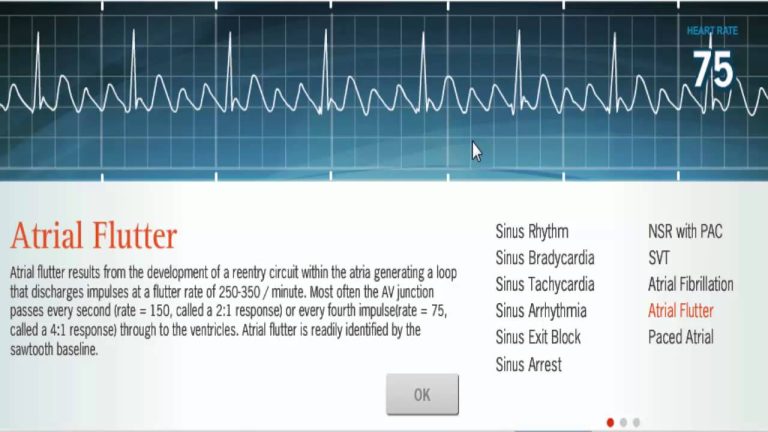 How to Pass the Prophecy Ekg Test