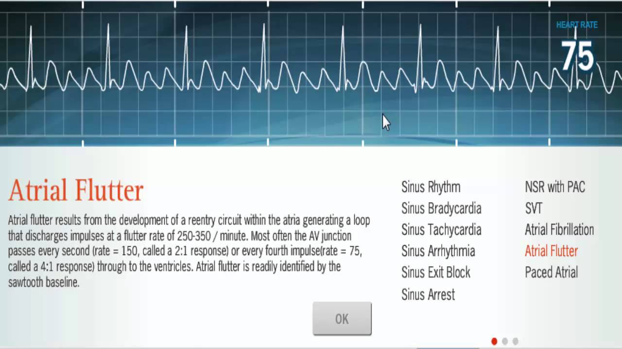 How to Pass the Prophecy Ekg Test