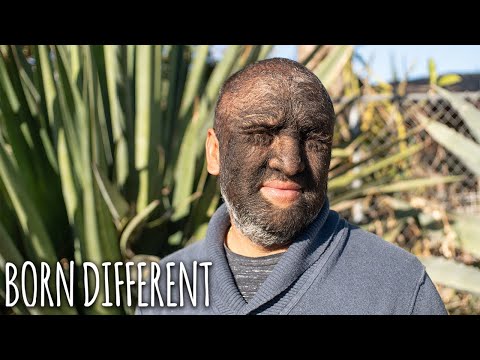 What Ethnicity Has A Lot Of Body Hair?